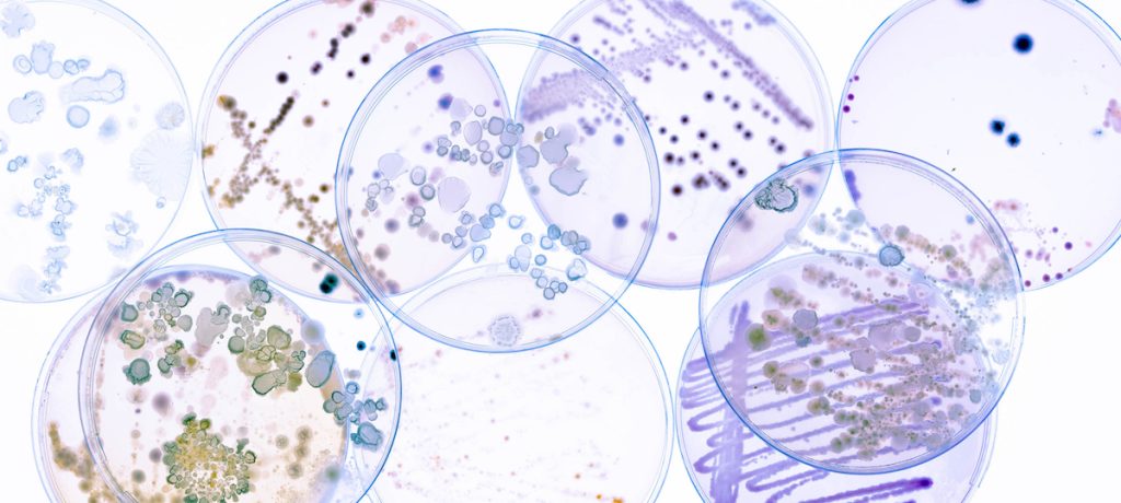 An assortment of soil bacteria strains selected for their specific properties